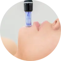 Microneedling at GCSkin