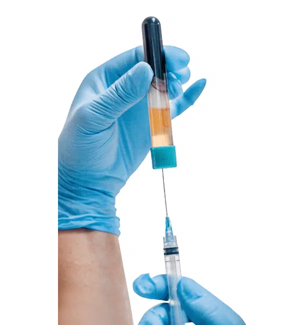 GCSkin Medspa Plasma Rich Fibrin PRF