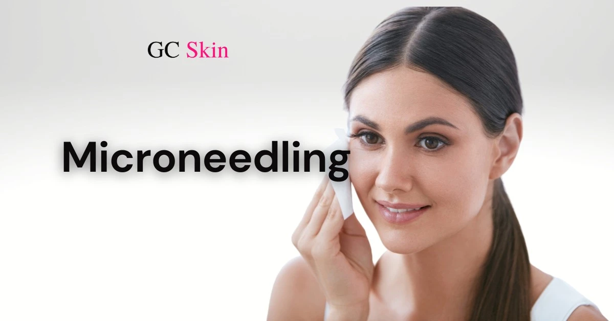 GCSkin microneedling Handout