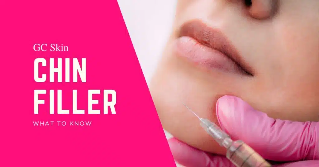 Chin Fillers at GC Skin Medspa Near Sherman Oaks