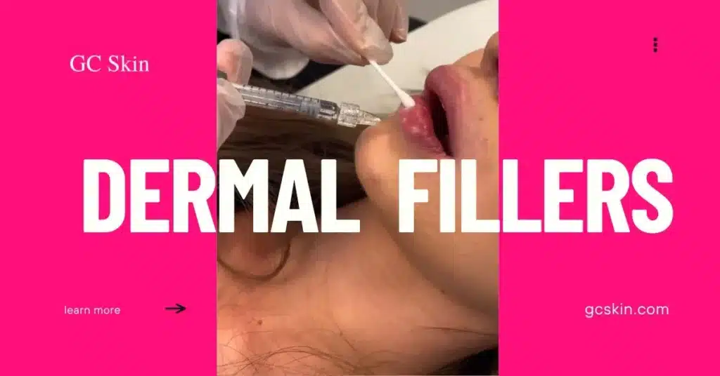 Dermal fillers at GC Skin Medspa near Sherman Oaks