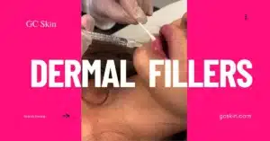 Dermal fillers at GC Skin Medspa near Sherman Oaks