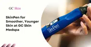 Microneedling in Sherman Oaks: SkinPen for Smoother, Younger Skin at GC Skin Medspa