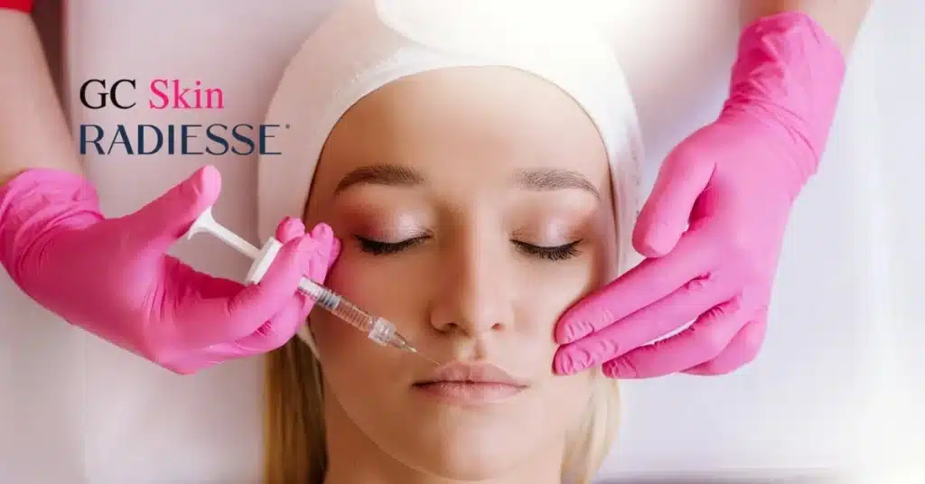 Radiesse in Sherman Oaks: The “Filler That Keeps Giving” for Crepey Skin & Natural Rejuvenation